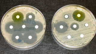 Antibiotic Resistance Could Spark Devastating Outbreaks